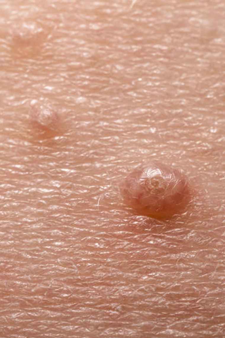 Neotoma Skin Nova Dermatology